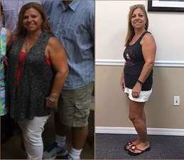 Cynthia Before and After Weight Loss Progress